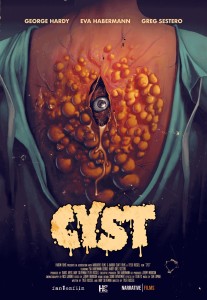 cyst-2020-poster